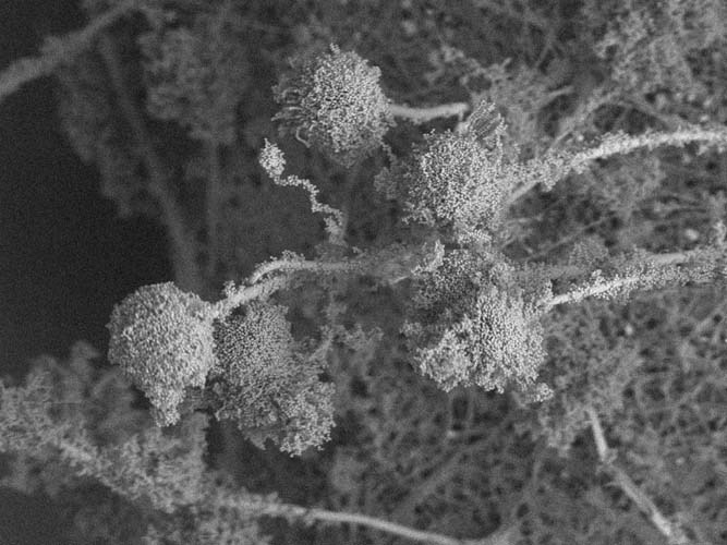 黒カビの胞子と菌糸の顕微鏡写真